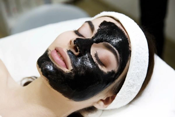 Is Carbon Laser Peel Good for Oily and Acne-Prone Skin?