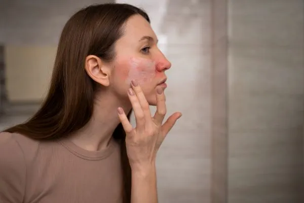 Signs Your Skin Barrier Is Damaged and How to Repair It | Expert Skin Care Guide