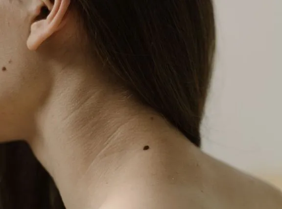 Dark Neck: Causes, Treatment Options & Prevention