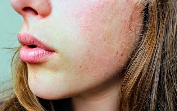 How Pollution Affects Your Skin More Than You Think: Causes & Solutions