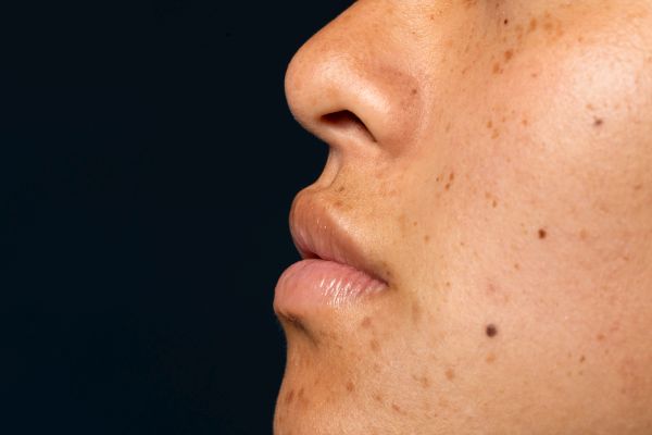 How to Get Even Skin Tone
