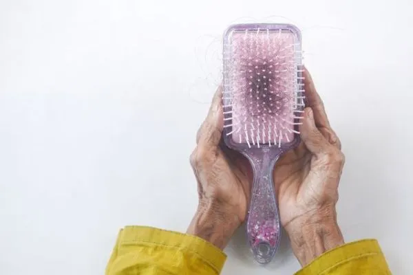Hair Fall After Stress, Illness or Weight Loss: What Causes It and When to Seek Help
