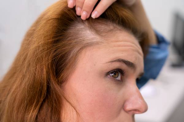 How to Restore Thinning Hair