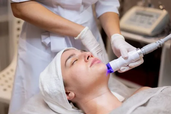 HydraFacial vs Chemical Peel: Which Gives Better Glow Before a Wedding?