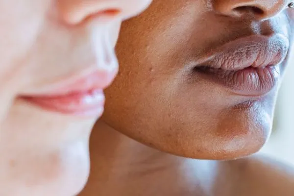 Pigmentation Around the Mouth: Causes & Treatment Options