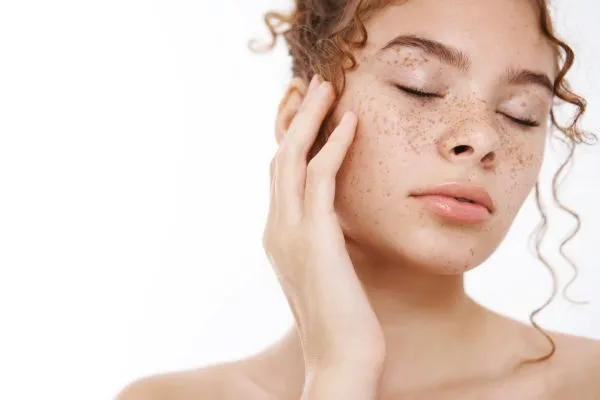 Why Does Melasma Keep Coming Back?