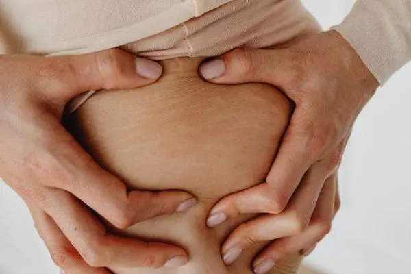 Why Stretch Marks Look Different in Everyone