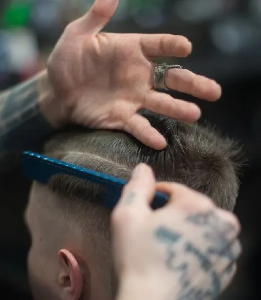 Dermaroller Treatment