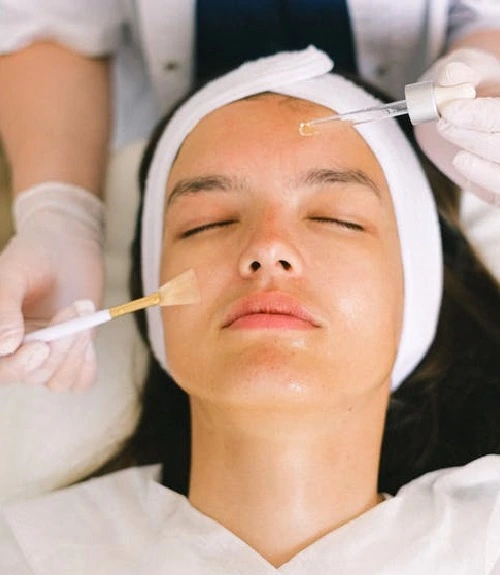 Chemical Peel Treatment in Hyderabad