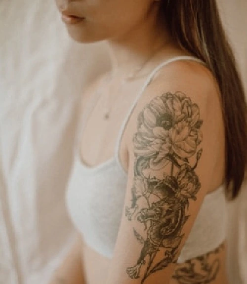 Laser Tattoo Removal Hyderabad