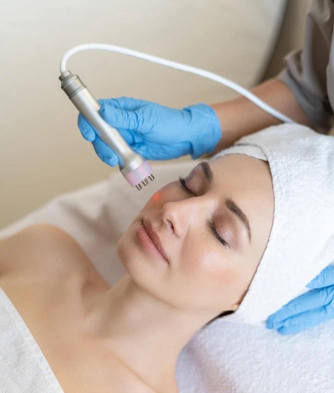 Pigmentation Laser Treatments